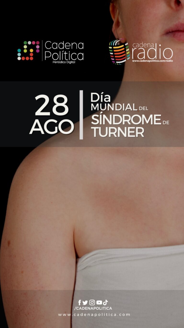 ¿conoces Porque Es El Día Internacional Del Síndrome De Turner