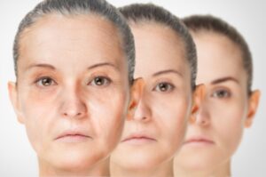 Aging process, rejuvenation anti-aging skin procedures