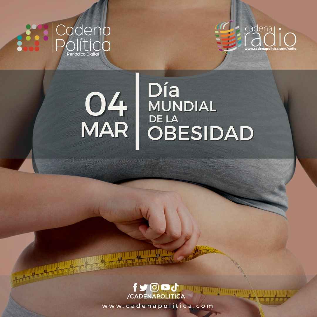 Obesidad