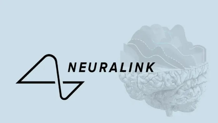 Neuralink