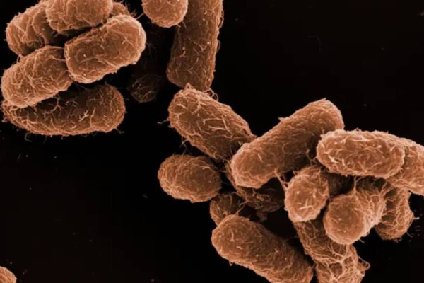 Alerta epidemiológica: brote de Klebsiella oxytoca en CDMX