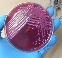 Klebsiella oxytoca