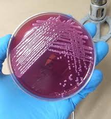 Klebsiella oxytoca