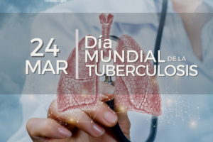 Tuberculosis