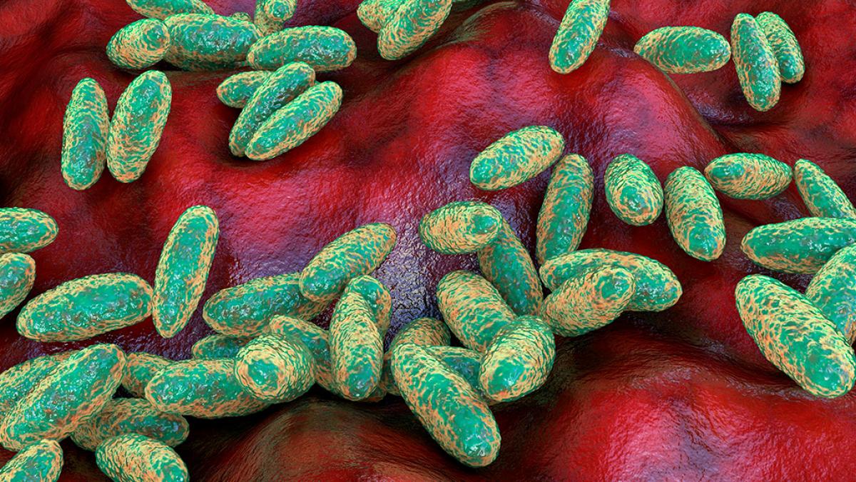 Yersinia pestis