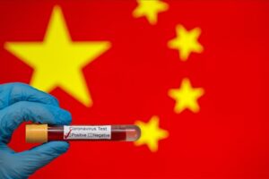 investigación China Covid-19