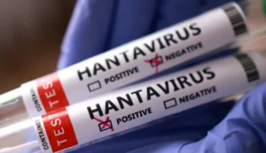 Hantavirus Andes