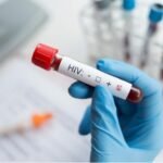 CDMX vive epidemia de VIH y se ubica entre los estados con más casos en México