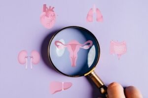 Síndrome Ovárico Metabólico Poliendocrino