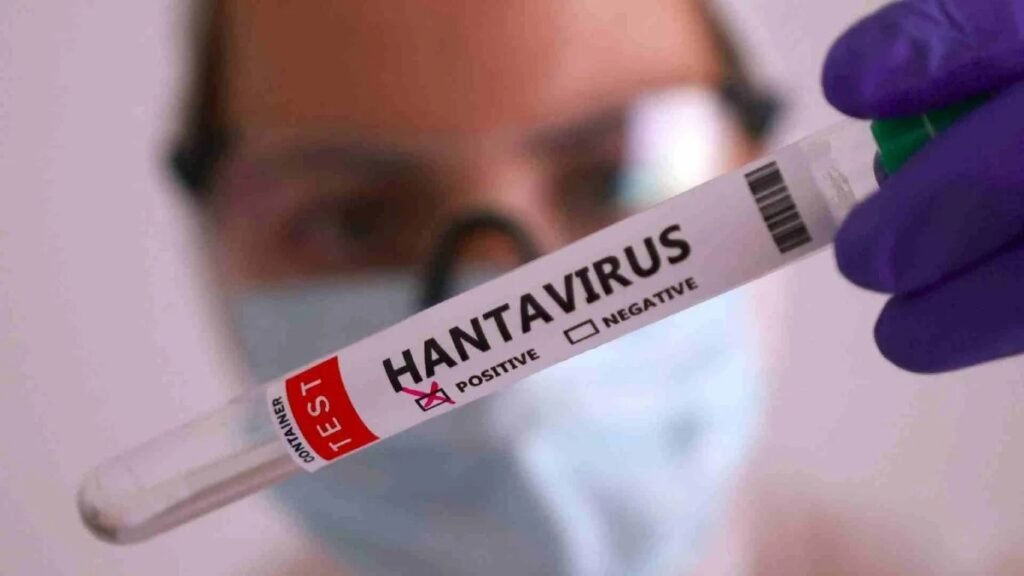 brote hantavirus buque