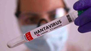 brote hantavirus buque