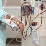 El costo de la improvisación: 9 de cada 10 pacientes renales inician diálisis en urgencias en México