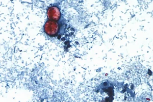 Cyclospora