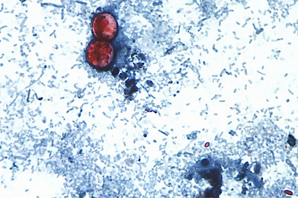 Cyclospora
