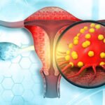 México avanza en la meta de la OMS para eliminar el cáncer cervicouterino con casi 2 millones de vacunas